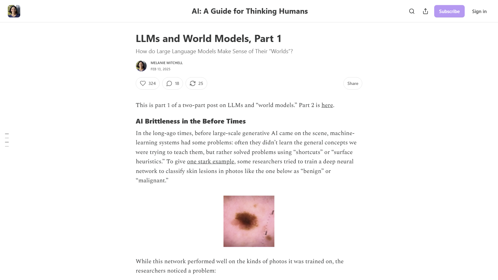Substack article page headed "LLMs and World Models, Part 1" with the subtitle "How do Large Language Models Make Sense of Their Worlds?", byline Melanie Mitchell dated Feb 13, 2025, the opening section "AI Brittleness in the Before Times," and a dermatology photo of a skin lesion used as an example image